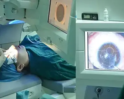 Laser surgery